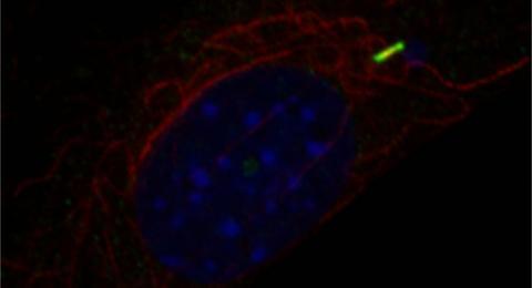 Staðsetning Hedgehog-boðleiðarinnar í mannafrumu. Kjarninn er litaður blár, asetýleraðar örpíplur rauðar og Hedgehog prótínið SMO grænt.
